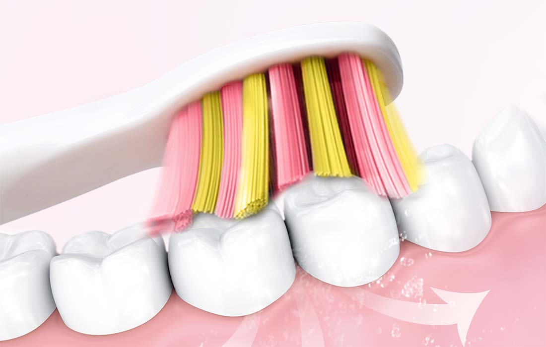 Електрическа ултразвукова четка за зъби FairyWill FW-507 с 8 накрайника и калъф, Розов