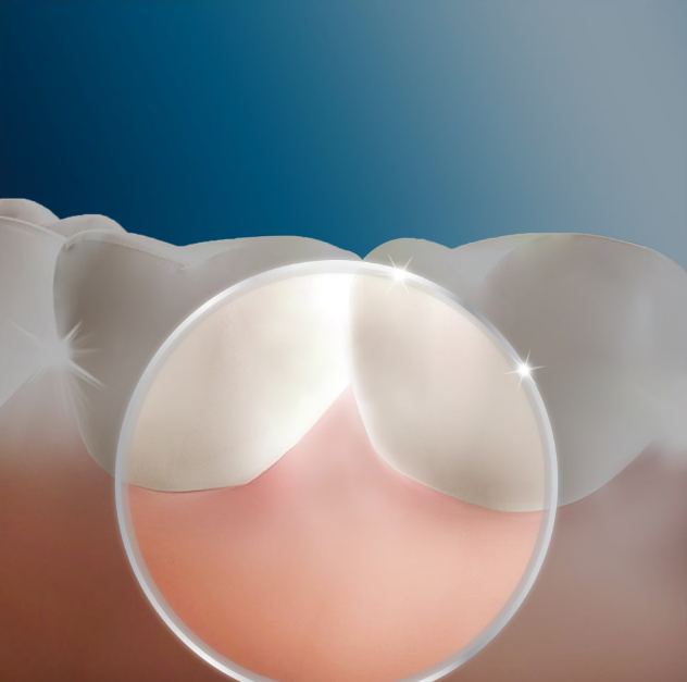 Зъбен душ Oral-B Oxyjet MD20, 600 мл, Бял