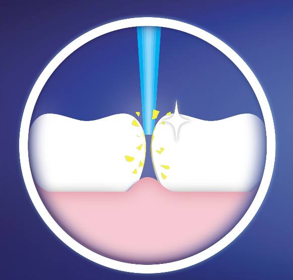 Накрайник за електрическа четка Oral-B Interspace IP17-2, 2 бр